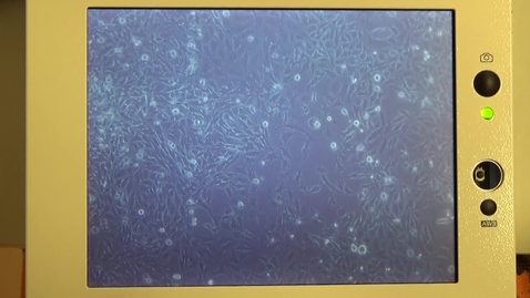 Thumbnail for Tissue Culture, passing adherent cells